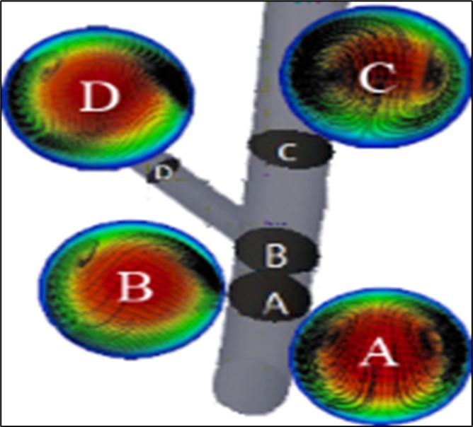 a) Contours of axial velocity of blood flow and streamlines of formed secondary flows at different cross sections, and b)axial velocity profilesat the mentioned lines in the modeled ideal geometry.