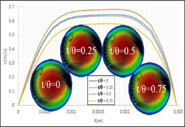 Effects of pulse inlet flow on the contours and profiles of axial velocity of blood flow and streamlines of formed secondary flows at the bifurcation cross section.