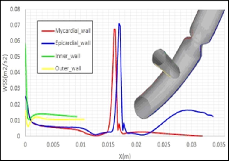 a)Contour and b)profiles of the entered shear stress by the fluid flow to the walls of an artery with a stenosis using the present model with a static mesh.