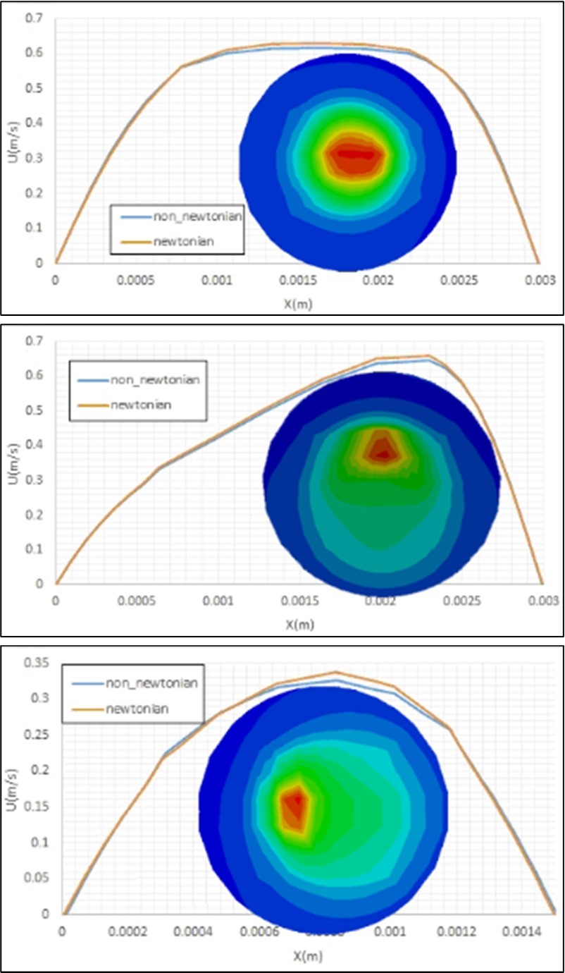 Effects of considering of the blood flow as a non. Non-Newtonian fluid on the axial velocity profile and the viscosity contours at different cross sections (i.e.a) at the bifurcation, b) 6d after the bifurcation and c) 2d before the bifurcation) of the healthy artery.