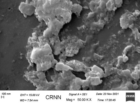 SEM study of attogram level stroked antigen in alcohol. It indicates the presence of many nanoparticles originating from the antigen molecules along with some larger particles of silica probably originated from the surface of the glass container during strokes.