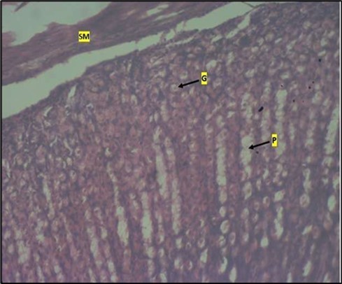 Image of a wistar rats stomach treated with high dose of abelmoschus esculentus showing dysplasia of gastric pits with the arrows mark (p). Goblet cells mark with arrow (g) appear at the basal mucosa and smooth muscle (sm) appear mildly eroded. The slide was stained using h & e technique. X100