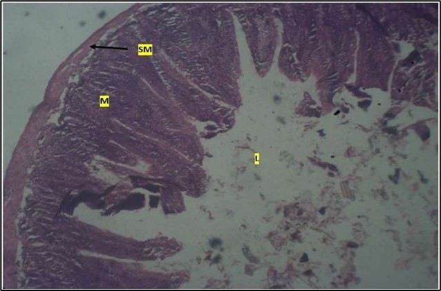 Control showing the mucosa with intestinal villi (v) projecting towards the lumen (l) and the underlying smooth muscle layer (sm) all appearing normal