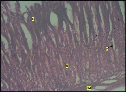 control plate showing gastric pits with goblets cells (g). Smooth muscle layer (SM) and surface epithelium (e) appears normal. (H&E).