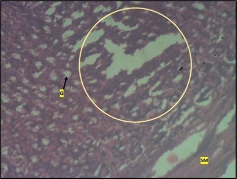 Image showing deep epithelial gastric pit area with marked depletion of pits and goblet cells (circled area). Smooth muscle (sm) appears normal in animals treated with Low dose of Abelmoschus esculentus stained with H & E technique X100