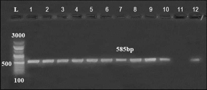 Agarose gel electrophoresis showing amplification of hly gene (450bp) Lane 1-6, 9, 10 positive samples. Lane 7, 8, 11-14: negative samples.