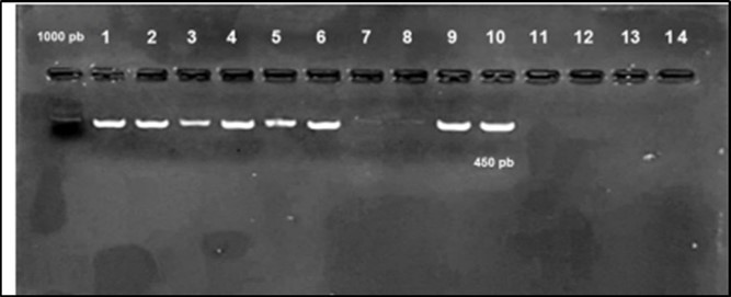 Agarose gel electrophoresis showing amplification of hly gene (450bp) Lane 1-6, 9, 10 positive samples. Lane 7, 8, 11-14: negative samples.