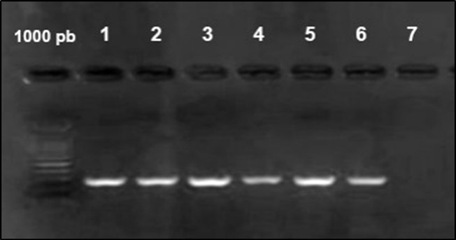 Agarose gel electrophoresis showing amplification of iut Agene (302bp) Lane 1-6: positive samples. Lane 7 negative samples.