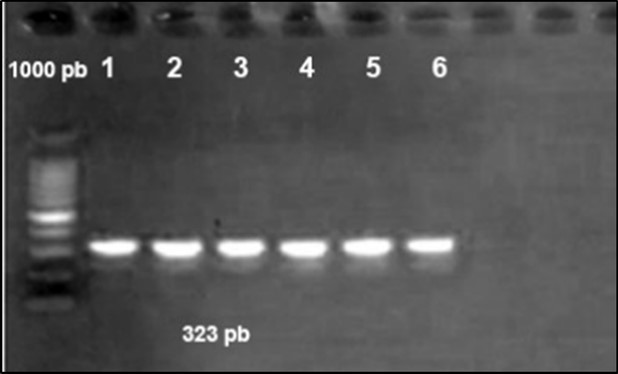 Agarose gel electrophoresis showing amplification of issgene (323bp) Lane 1-6: positive samples. Lane 7,8: negative samples.