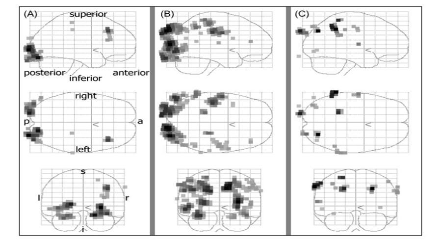 Result of stimulation 2. The black areas denote active brain regions (P<0.05). (A) Condition 1. Activations was detected in bilaterally primary visual cortex. (B) Condition 2. Activations was detected in bilaterally primary visual cortex. (C) Condition 3. Activations was not detected in primary visual cortex.