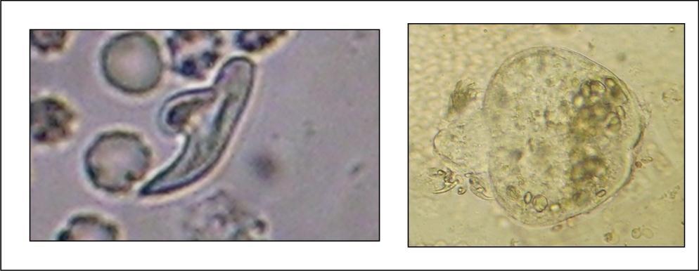 photomicrograph showing hydatid scoleces and their hooks after centrifugation (original magnification, x100).