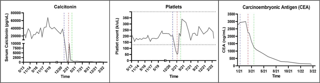 Biomarker Response. The patient’s calcitonin, platelet, and carcinoembryonic antigen levels were trended from May 2013 to March 2022. The dashed blue, red, and green lines indicate the start of Pralsetinib (400 mg PO QD), temporary hold of Pralsetinib due to grade 3 thrombocytopenia, and restarting of Pralsetinib at 200 mg PO QD respectively. Pralasetinib was effective in disease control as evidenced by significantly decreased calcitonin and CEA levels. When Pralsetinib held for thrombocytopenia, calcitonin level increased sharply. Pralsetinib at 200mg PO QD dose was adequate and effective in decreasing calcitonin and CEA levels without inducing thrombocytopenia.