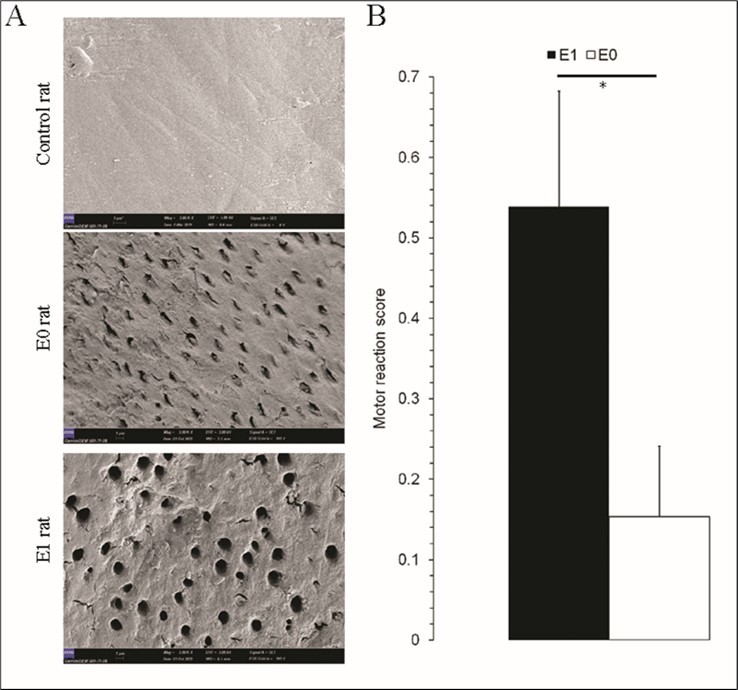 Jet injection of cold water to erosive molar triggers pain-related behavioral response in rats. A: Representative images of samples (SEM) with normal (top, control rat) and severe dentin erosion (middle and bottom). B: Motor reaction scores of rats with dentin erosion to warmish water (E0, n = 13) and cold water (Group E1, n = 13).