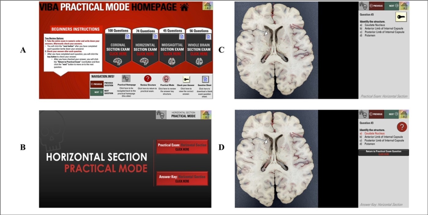 VIBA Plastinated Brain Practical Mode. (A) Practical Mode Homepage. (B) The main page of the practical mode section. (C) Question. (D) Answer Key