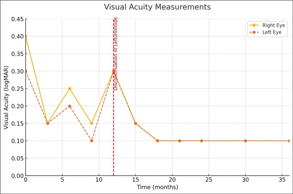 Visual acuity (logMAR) measurements before and after discontinuation of Leflunomide.