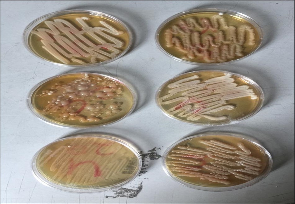 Plates showing Culture Positive Cases