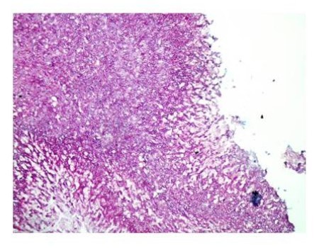 Light Green PAS stain with filamentous branching bacteria at 10x magnification