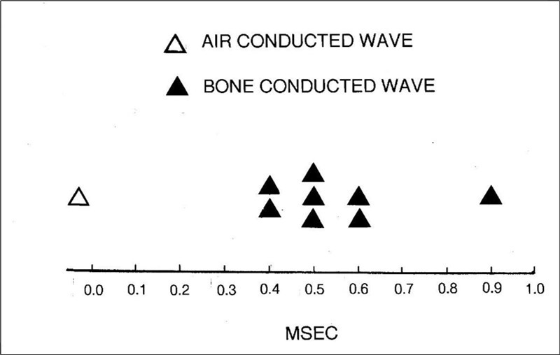 The time difference between an air-conducted BAEP wave and its homologous bone-conducted wave. In this case, the component analyzed is wave V for reasons described in the text. The data in the figure is derived from eight separate studies using human adults as subjects.