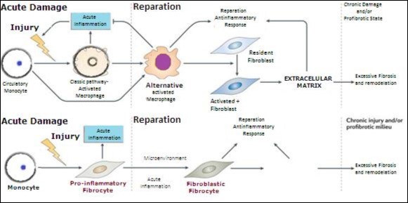 Direct and indirect way of activation of fibroblasts by monocyte-macrophages.