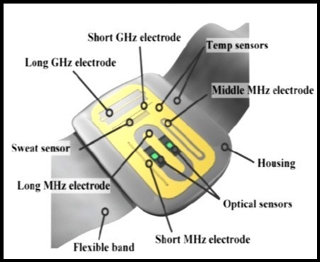 Schematic illustration of the multisensor system, having electrodes of dielectric sensor and optical diffuse reflectance sensor (Published with permission) 134.