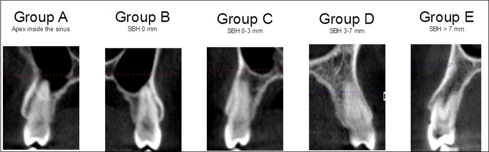 Classification in five different categories for premolars