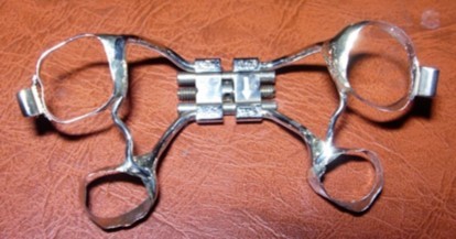 Banded Rapid Palatal Appliance