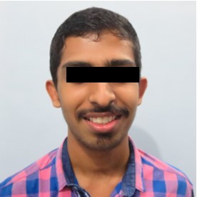 Post-treatment extra-oral-Smiling