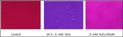 Resveratrol treatment protected astrocytes from H2O2 induced-injury. The left image shows the normal control astrocytes grown in DMEM media. The center image shows the astrocyte injury after 24 hours of 0.5mM H2O2 treatment. The cell became bluefish because the majority of the cells were dead as the result of H2O2 injury. The right image shows the astrocytes simultaneously protected with 75μM resveratrol treatment given at the onset of H2O2-induced injury. Resveratrol-protected cells were viable and able to metabolize alamar blue and turn it into pink color. All microscope photographs are in 10X magnification.