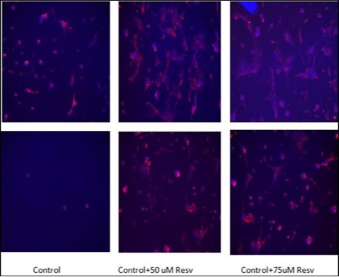 Immunocytochemistry analysis of GFAP expression (red color) in resveratrol-protected astrocytes after 24 h of 0.5 mM H2O2 injury (bottom panels). DAPI nuclear stain was used to visualize cell nuclei (blue color). Left images, astrocytes without resveratrol protection; middle images, astrocytes protected with 50 μM resveratrol, right images, astrocytes protected with 75 μM resveratrol.