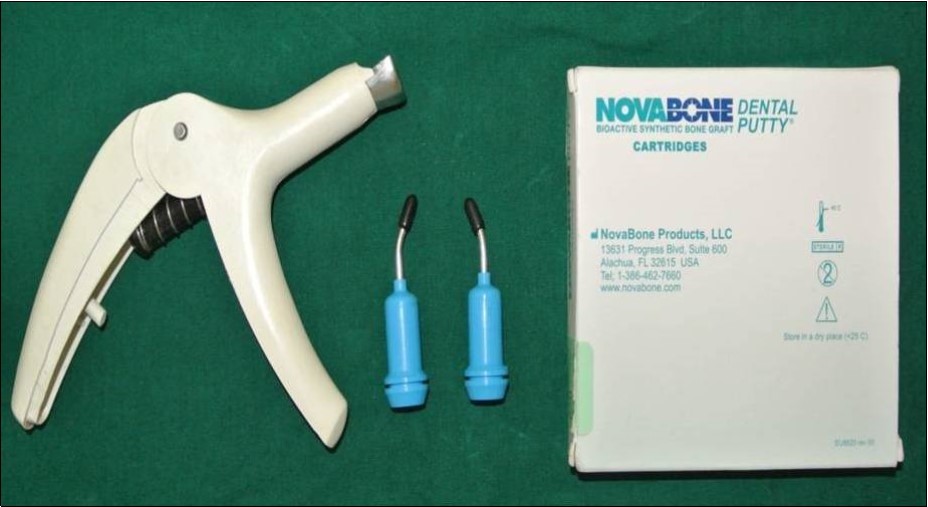 calcium phosphosilicate (CPS) putty (Nova bone dental putty, Novabone products, Alachua, Fla) used as graft material;