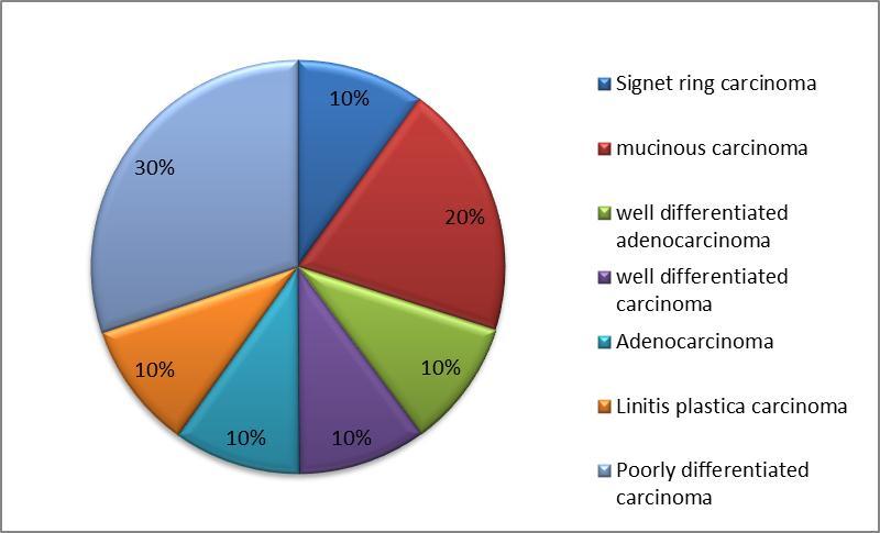 Histopathological features of Epstein - Barr virus associated with Gastric Carcinoma