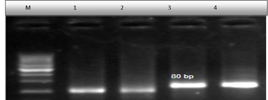 PCR Results of EBNA1 gene in patients with Gastric carcinoma Lanes 1 is control negative for EBV gene. Lane 2 visualized PCR negative. Lane 3 clear band is visualized (positive PCR result) for EBV gene, Lanes 4 is control positive for EBV gene. M: 50 bp DNA size markers on 2% agarose gel.