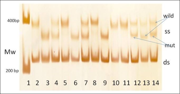 The screening PCR-SSCP method yields different migrations for the single stranded SSCP bands (ss) and the double stranded SSCP bands (ds). Lane 1: Mw markers, Lane 2-14 - patients’ samples, rs769217 polymorphism: wild types(CC) in lanes: 2,5,8,10,11, heterozygous (CT) in lanes: 4,7,13 and mutant homozygous (TT) in lanes 3,6,9. c.1060G>A heterozygous mutation in lane 12 and c.1093C>T heterozygous mutation in lane 14.