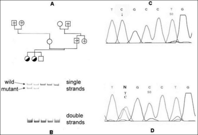 Detection of a Hungarian acatalasemic family with this method. Pedigree (A), SSCP pattern with new method (B), nucleotide sequence analyses of wild type(C) and heterozygote mutant (D).