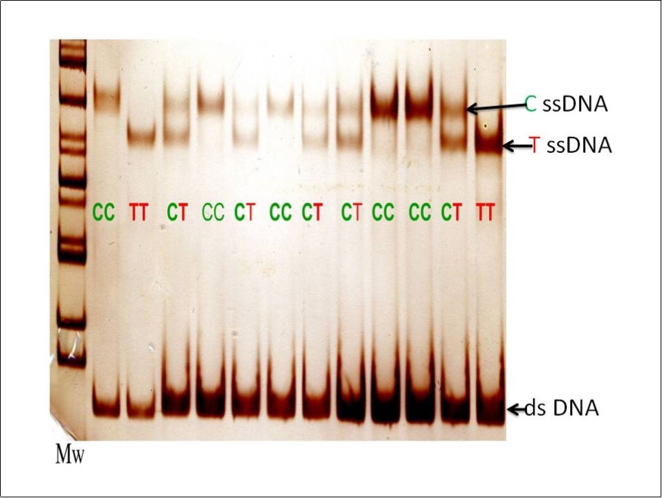 Evaluation of rs769217 polymorphism in exon 9 of catalase gene with the screening SSCP method in patients with non insulin dependent diabetes mellitus