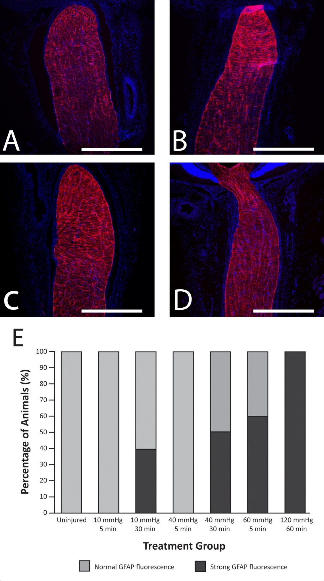 GFAP labelling (red) in the optic nerve 4 hours post IOP manipulation. Blue labelling is DAPI for cell nuclei. (A) An optic nerve from the uninjured (i.e. completely naïve) group showing uniform GFAP fluorescence in both the anterior (first 500 µm) and posterior optic nerve. (B) An optic nerve from the 120 mmHg 60 minute group showing much stronger GFAP labelling in the anterior part of the optic nerve compared to the posterior part - this sample was assigned to the ‘strong’ labelling group. (C) Optic nerves from the 40 mmHg 30 minute group and (D) 60 mmHg 5 minute group showing stronger GFAP in the anterior optic nerve compared to the posterior optic nerve. Scale bar = 500 µm. (E) Graph showing the percentage of animals with normal (pale grey) or strong (dark grey) GFAP fluorescence in the anterior optic nerve (first 500 µm) examined 4 hours after transiently raised IOP for different periods of time. n = 6, 5, 5, 10, 10, 10, 5, respectively, from left to right.