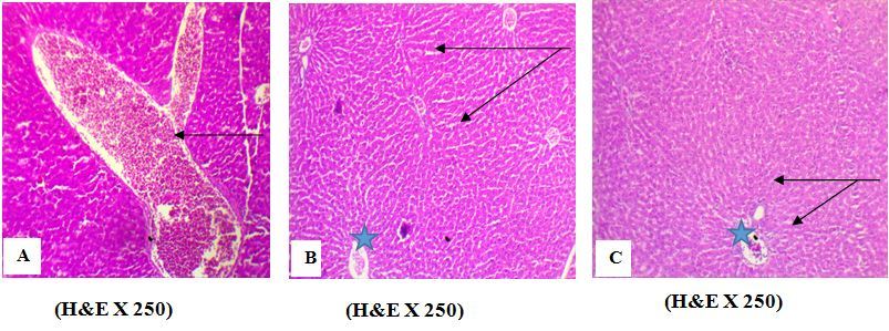 Effect of AFB1 on liver tissues. A photomicrograph of liver section from (A) Liver of rat treated with AFB1 alone (group 2) showing a sinusoid capillary dilation with hemorrhagic contents (arrow), (B) rat treated with AFB1 + EELac at 300 mg/kg (group 5) showed the normal hepatocytes (arrow) ¶ and portal area (star) without histological abnormalities¶, (C) rat Treated with AFB1+ BHA at 50 mg/kg (group 6) showed the normal hepatocytes (arrow) ¶ and portal area (star) without histological abnormalities.