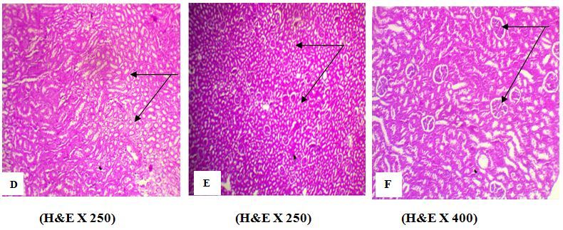Effect of AFB1 on kidney tissues. A photomicrograph of kidney section from (D) kidney of rat treated with AFB1 alone (group 2) showed an atrophy of renal tubules (arrow), (B) Rat Treated with AFB1 + EELac at 300 mg/kg (group 5) showed a normal histology of renal tubules (arrow), (C) Rats Treated with AFB1 + BHA at 50 mg/kg (group 6) showed a normal histology of renal tubules and renal glomeruli (arrow). ¶