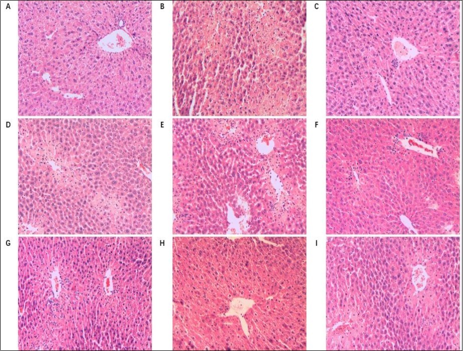 Effect of T01-TPS (100, 300, 600mg/kg), T09-TPS (100, 300, 600mg/kg) and Bifendate on liver histopathology of CCl4 treated mice (HE×200). (A) liver section of NCG(normal control group); (B) liver section of MCG(CCl4 model group); (B) liver section of PCG(Bifendate( 100 mg/kg) + CCl4); (D-F) liver section of T01-TPS(100,300, 600mg/kg) + CCl4 group; (G-I) liver section of T09-TPS(100,300, 600mg/kg) + CCl4 group