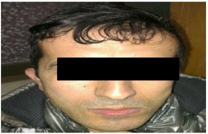 The patient’s clinical features