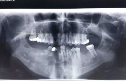 The patient’s intraoral view