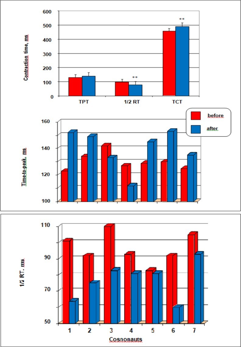 The effects of long-term space flights on velocity properties. Time-to-peak twitch (TPT), and time to half-relaxation (1/2 RT), and total contraction time (TCT) before and after prolonged space flights (top panel), and the histograms represent the individual TPT (middle panel), and made an interval 1/2RT (bottom panel) values of each cosmonaut from baseline data collections and 3 days after return test. All values are means ± SE. Significantly different between groups for corresponding contractions: **p < 0.05