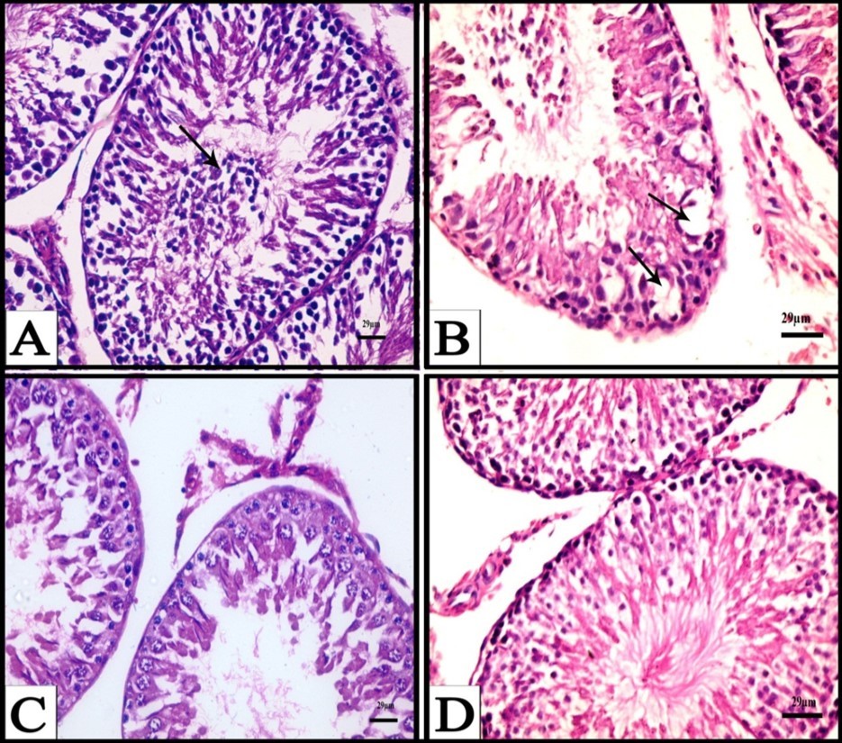 A) A Photomicrograph obtained from testis of a rat treated with CPA for six weeks showing exfoliated cells (arrows), (H&E). B) A Photomicrograph obtained from testis of a rat treated with CPA for six weeks showing appearance of vacuoles (arrows) and degenerated spermatogenic cells, (H&E). C) A Photomicrograph obtained from testis of a rat treated with CPA for six weeks showing degenerative interstitial tissue and reduced and n degenerated spermatogenic cells, (H&E). D) A Photomicrograph obtained from testis of a rat treated with CPA followed by fennel oil for six weeks showing advanced degree of improvement of seminiferous tubules and increase of spermatogenic layers, (H&E).