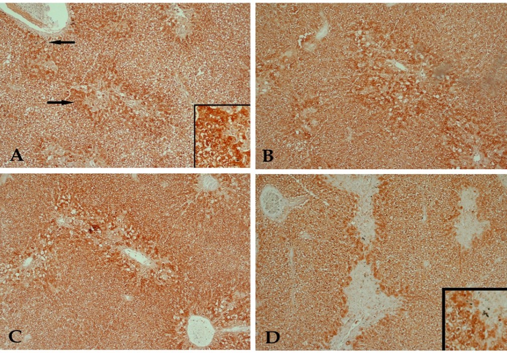 A photomicrograph of a section of liver tissue stained with anti-caspase-3 antibody with streptavidin-biotin from (A) control rat receiving CCl4 showing many hepatocytes with positive immune- reaction to the stain (arrow). (B) CCl4 and 10 mg/kg buspirone showing a result close to that of the previous group. (C) CCl4 and 20 mg/kg buspirone showing minimal reduction of the positively stained cells. (D) CCl4 and 30 mg/kg buspirone showing mild reduction of the positively stained cells
