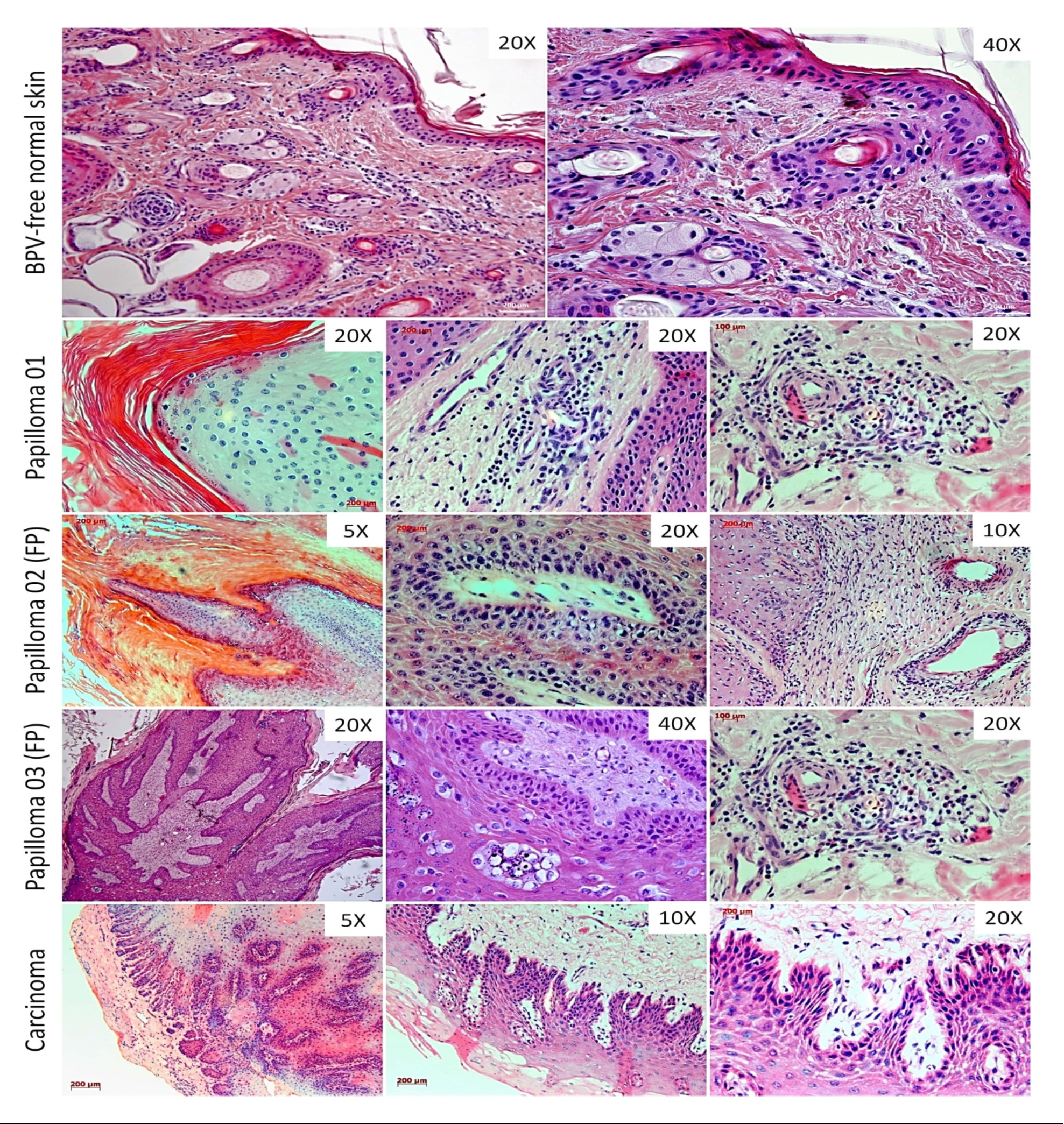 Histopathological analysis showing the tissue architecture preservation in BPV-free normal skin. The cutaneous papilloma, fibropapilloma (FP) and esophageal carcinoma showed acanthosis and koilocytosis, characteristics even verified in BPV-infected lesions. The samples of papilloma 02 and 03 showed a fibroelastic and reactive dermis, due to these characteristics, these samples were classified as fibropailloma (FB). Both cutaneous papilloma and fibropapilloma showed an extensive inflammatory infiltrate into the dermis. Esophageal carcinoma exhibited the sites of atypia, where was verified the loss of cell polarity, the presence of cancer cell islands into the dermis, comprised by fibroblastoid keratinocytes, being compatible with epithelial-mesenchymal transition (EMT).