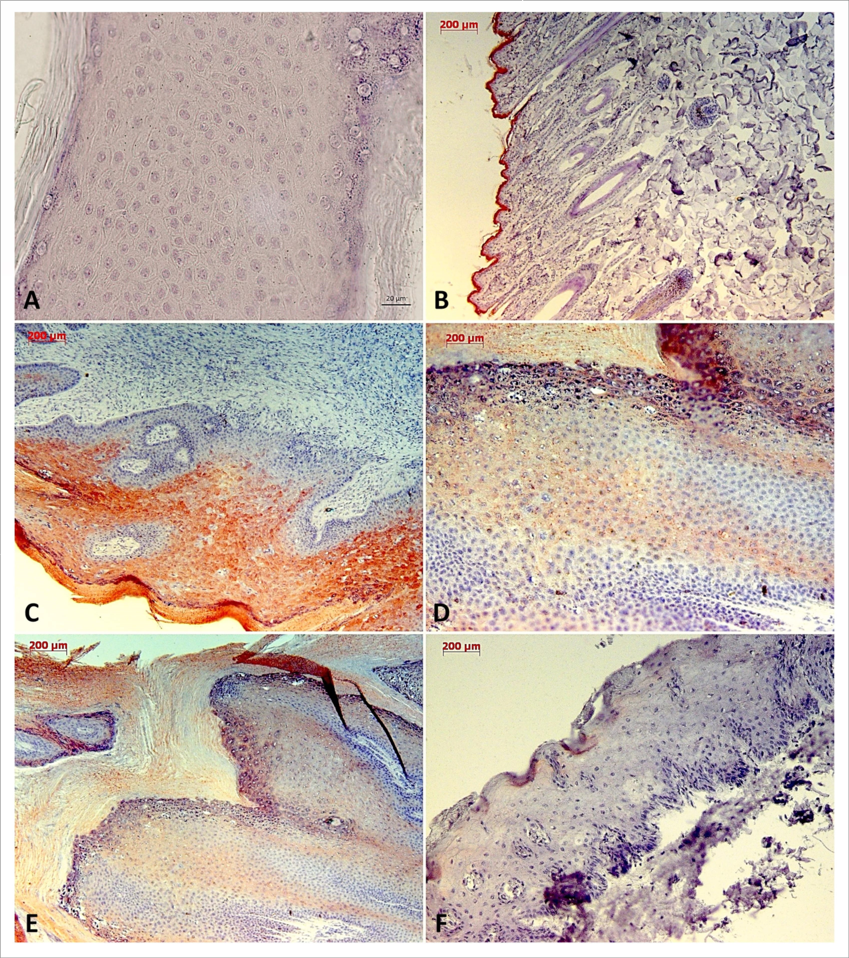 Immunodetection of cytokeratin 10 (CK10) showing the protein expression restricted to the epithelium of BPV-free normal skin (A), reinforcing the tissue architecture preservation, and the absence of labeling in negative control (B, cutaneous papilloma incubated exclusively with secondary antibody).Results show an expressive immunodetection of CK10 in suprabasal layer of cutaneous papilloma (C). However, was verified a downregulation of CK10 expression levels in fibropapilloma (D and E – papilloma 02 and 03, respectively) and esophageal carcinoma (F). Images obtained using objectives of 5X (B, C, E and F), 10X (D) and 20X (A).