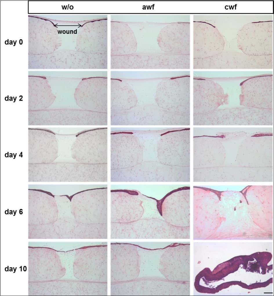 Histological characterization of wound healing in the presence of acute or chronic wound fluid. H/E-staining of frontal sections of the 3D wound models. All models showed an approximation of the wound edges after 4 days. With regard to migration, keratinocytes showed no difference after AWF addition compared to the control. CWF supplementation stimulated the proliferation resulting in hyperplasia after 10 days. In contrast, a fibroblast cell loss was detected under CWF challenge. The models completely lost their shape presumably due to collagen degradation. Scale bar: 200 µm