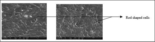 Morphology of NFKVG 8 and NFKVG 10 under 11000 x magnification