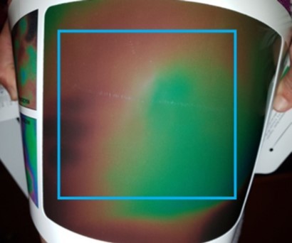 Thermography of the thigh. Blue frame: inside, the area included in the colorimetric analysis.