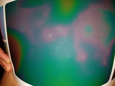 Abdominal thermography (left flank). Range of colors displayed with the Thermoplate®30 (standard): blue, red and green.